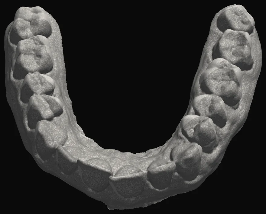 Scansione 3D reale di un'arcata dentata