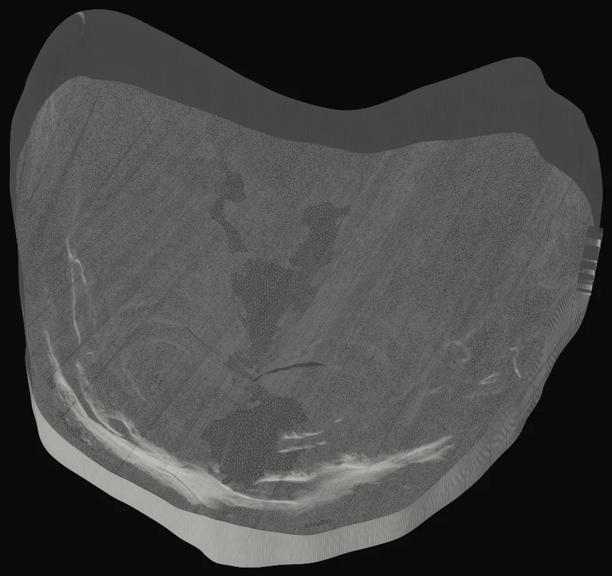 Scansione 3D reale di una cresta edentula